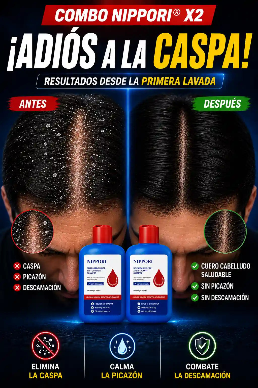 COMBO NIPPORI® X2 - ¡ELIMINA LA CASPA, LA PICAZÓN Y LA DESCAMACIÓN DESDE LA PRIMERA LAVADA!