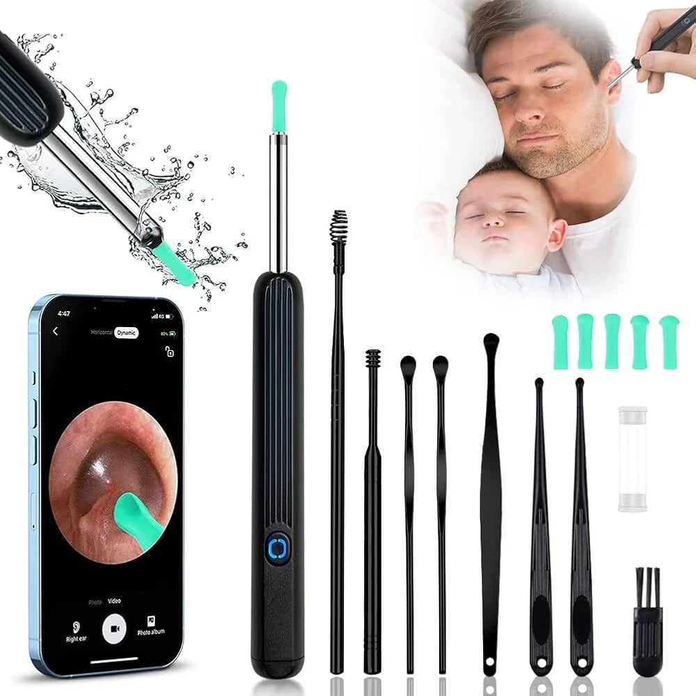 KIT LIMPIADOR DE OÍDOS CON CÁMARA HD – DI ADIÓS A LOS COPITOS