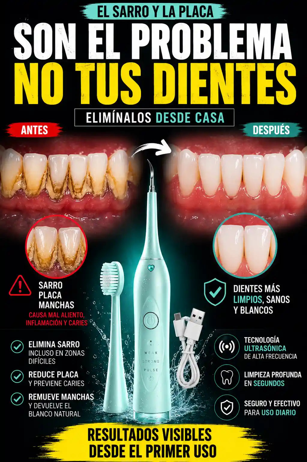 LIMPIADOR DENTAL ULTRASÓNICO 3 EN 1 | ELIMINA SARRO, PLACA Y MANCHAS