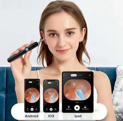 KIT LIMPIADOR DE OÍDOS CON CÁMARA HD – DI ADIÓS A LOS COPITOS
