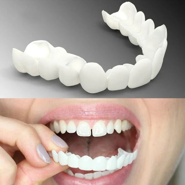 CARILLAS SNAP-ON SMILE: ¡TRANSFORMA TU SONRISA EN SEGUNDOS!