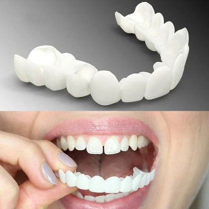 CARILLAS SNAP-ON SMILE: ¡TRANSFORMA TU SONRISA EN SEGUNDOS!