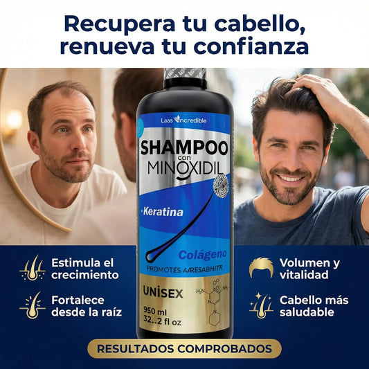 SHAMPOO MINOXIDIL PRO – ACTIVA EL CRECIMIENTO Y FRENA LA CAÍDA